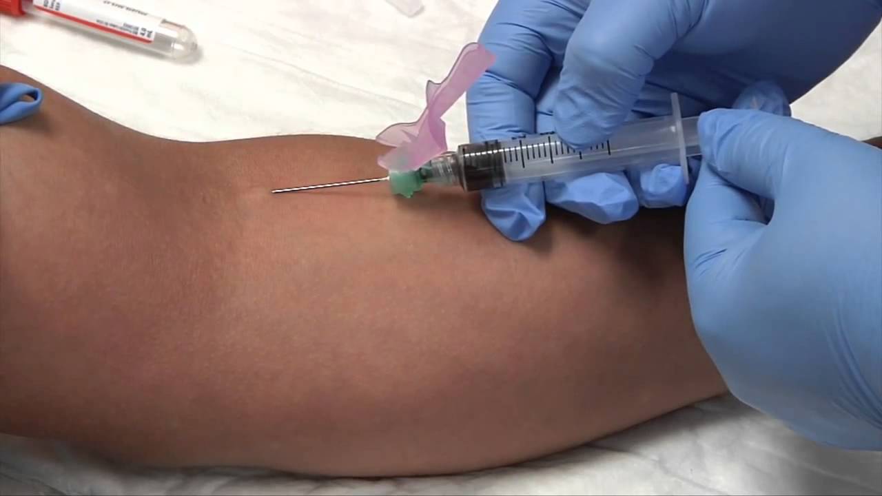 phlebotomy procedure