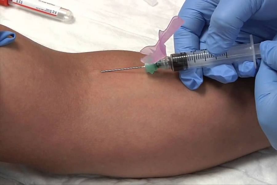 phlebotomy procedure