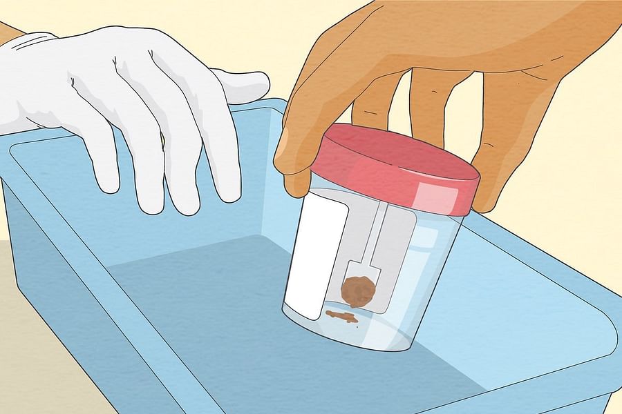 specimen collection medical